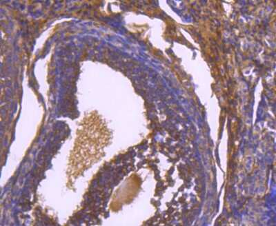 Immunohistochemistry-Paraffin: Paxillin Antibody (SY23-02) [NBP2-67427] - Analysis of paraffin-embedded mouse ovary tissue using anti-Paxillin antibody. Counter stained with hematoxylin.