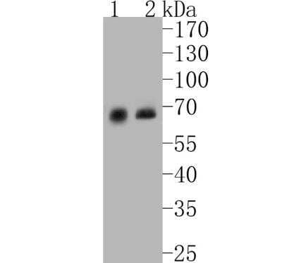 Western Blot: Paxillin Antibody (SY23-02) [NBP2-67427] - Analysis of Paxillin on different lysates. Proteins were transferred to a PVDF membrane and blocked with 5% BSA in PBS for 1 hour at room temperature. The primary antibody (1/500) was used in 5% BSA at room temperature for 2 hours. Goat Anti-Rabbit IgG - HRP Secondary Antibody (HA1001) at 1:5,000 dilution was used for 1 hour at room temperature.Positive control: Lane 1: NIH/3T3 cell lysateLane 2: A549 cell lysate