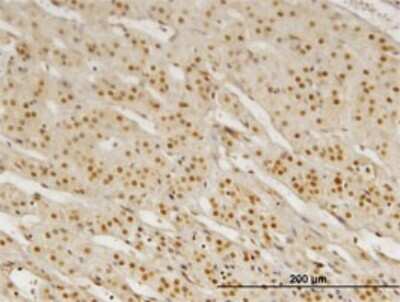 Immunohistochemistry-Paraffin: Pbx3 Antibody (1A11) [H00005090-M02] - Analysis of monoclonal antibody to PBX3 on formalin-fixed paraffin-embedded human adrenal gland. Antibody concentration 1.2 ug/ml.