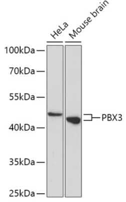 Western Blot: Pbx3 Antibody [NBP2-93576] - Analysis of extracts of various cell lines, using Pbx3 at 1:1000 dilution.Secondary antibody: HRP Goat Anti-Rabbit IgG (H+L) at 1:10000 dilution.Lysates/proteins: 25ug per lane.Blocking buffer: 3% nonfat dry milk in TBST.Detection: ECL Basic Kit .Exposure time: 5min.