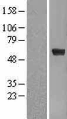 Western Blot: Pea3 Overexpression Lysate (Adult Normal) [NBL1-10359] Left-Empty vector transfected control cell lysate (HEK293 cell lysate); Right -Over-expression Lysate for Pea3.