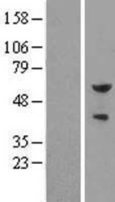 Western Blot: Pea3 Overexpression Lysate (Adult Normal) [NBL1-10360] Left-Empty vector transfected control cell lysate (HEK293 cell lysate); Right -Over-expression Lysate for Pea3.