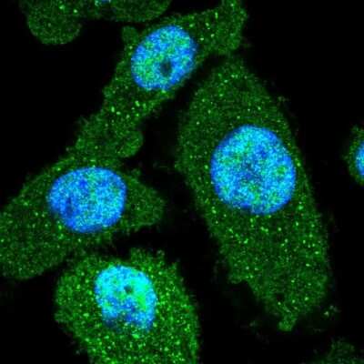 Immunocytochemistry/Immunofluorescence: Peflin Antibody [NBP2-56626] - Staining of human cell line PC-3 shows localization to nucleoplasm, cytosol & vesicles.
