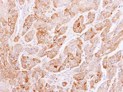 Immunohistochemistry-Paraffin Peflin Antibody