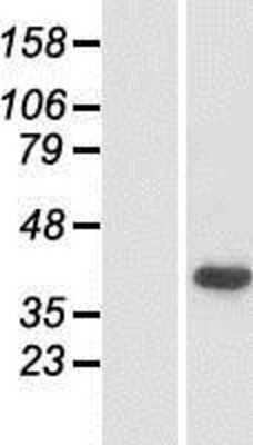 Western Blot: Pejvakin Overexpression Lysate (Adult Normal) [NBP2-10663] Left-Empty vector transfected control cell lysate (HEK293 cell lysate); Right -Over-expression Lysate for Pejvakin.