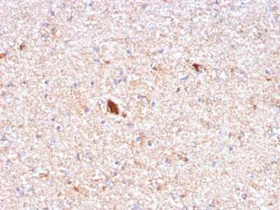 Immunohistochemistry-Paraffin: Pentraxin 2/SAP Antibody (APCS/3240) - Azide and BSA Free [NBP2-79848] - Formalin-fixed, paraffin-embedded human Brain stained with Pentraxin 2/SAP Antibody (APCS/3240).