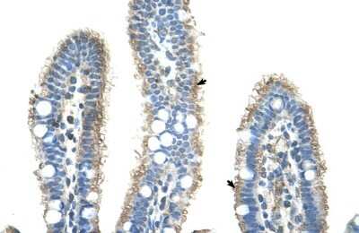 Immunohistochemistry-Paraffin: Pentraxin 2/SAP Antibody [NBP1-58970] - Human Intestine Tissue, antibody concentration 4-8ug/ml. Cells with positive label: Epithelial cells of intestinal villus (indicated with arrows) 400X magnification.