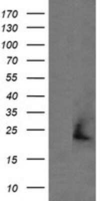 Western Blot: Pentraxin 2/SAP Antibody (OTI1D6) [NBP2-46530] - Analysis of HEK293T cells were transfected with the pCMV6-ENTRY control (Left lane) or pCMV6-ENTRY Pentraxin 2.