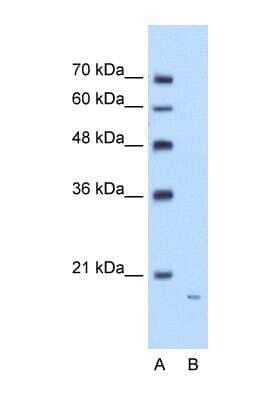 Western Blot: Pentraxin 2/SAP Antibody [NBP1-58970] - Jurkat cell lysate, Antibody Titration: 1.25ug/ml