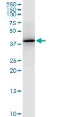 Western Blot: Pentraxin 3/TSG-14 Antibody (5B7) [H00005806-M01] - PTX3 monoclonal antibody (M01), clone 5B7. Analysis of PTX3 expression in PC-12.