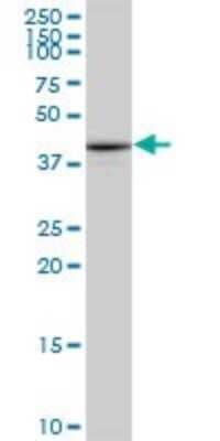 Western Blot: Pentraxin 3/TSG-14 Antibody (5B7) [H00005806-M01] - PTX3 monoclonal antibody (M01), clone 5B7. Analysis of PTX3 expression in NIH/3T3.