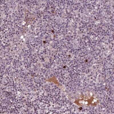 Immunohistochemistry Pentraxin 4 Antibody - BSA Free