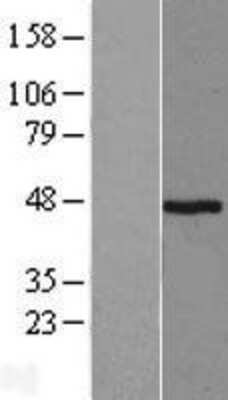 Western Blot: Pepsin A Overexpression Lysate (Adult Normal) [NBL1-14322] Left-Empty vector transfected control cell lysate (HEK293 cell lysate); Right -Over-expression Lysate for Pepsin A.