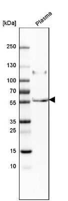 Western Blot: Peptidase Inhibitor 16/PI16 Antibody [NBP1-92254] - Analysis in human plasma.