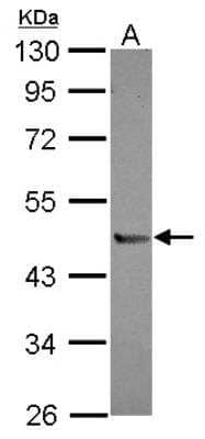 Western Blot: Peptidase Inhibitor 16/PI16 Antibody [NBP2-19771] -  Sample (30 ug of whole cell lysate) A: A549 10% SDS PAGE gel, diluted at 1:1000.