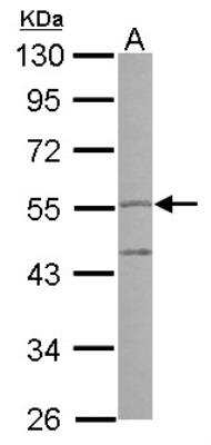 Western Blot: Peptidase Inhibitor 16/PI16 Antibody [NBP2-19773] -  Sample (30 ug of whole cell lysate) A: A549 10% SDS PAGE gel, diluted at 1:1000.