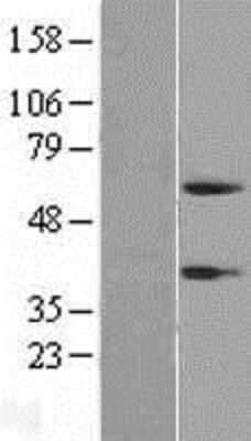 Western Blot: Peptidase inhibitor 16 Overexpression Lysate (Adult Normal) [NBP2-05262] Left-Empty vector transfected control cell lysate (HEK293 cell lysate); Right -Over-expression Lysate for Peptidase inhibitor 16.