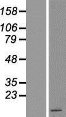 Western Blot: Peptide YY Overexpression Lysate (Adult Normal) [NBP2-10568] Left-Empty vector transfected control cell lysate (HEK293 cell lysate); Right -Over-expression Lysate for Peptide YY.