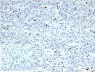 Immunohistochemistry-Paraffin: Perforin Antibody (PRF1/7077R) [NBP3-13751] - Formalin-fixed, paraffin-embedded human spleen stained with Perforin antibody (PRF1/7077R). Inset: PBS instead of primary antibody; secondary only negative control.