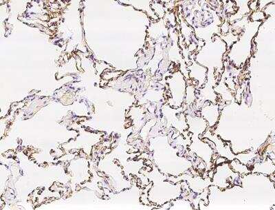 Immunohistochemistry-Paraffin: Periaxin Antibody [NBP3-06487] - Staining of human PRX in human lung with rabbit polyclonal antibody at 1:100 dilution.