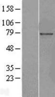 Western Blot Nucleoporin NUP85 Overexpression Lysate