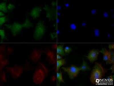Immunocytochemistry/Immunofluorescence: Perilipin-2/ADFP Antibody (2C5A3) - Azide and BSA Free [NBP2-80907] - HepG2 cells were fixed for 10 minutes using 10% formalin and then permeabilized for 5 minutes using 1X TBS + 0.5% Triton X-100. The cells were incubated with anti-ADFP/Perilipin-2 (2C5A3) NBP2-23486 at a 1:50 dilution overnight at 4C and detected with an anti-mouse Dylight 488 (Green) at a 1:500 dilution. Actin was counterstained using Phalloidin at a 1:200 dilution. Nuclei were counterstained with DAPI (Blue). Cells were imaged using a 40X objective. Image from the standard format of this antibody.
