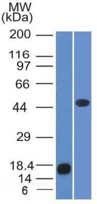 Western Blot: Perilipin-2/ADFP Antibody (ADFP/1365) [NBP2-47632] - Perilipin-2/ADFP Antibody (ADFP/1366) [NBP2-47632] - Analysis of recombinant Adipophilin and Jurkat Cell Lysate using Adipophilin Monoclonal Antibody (ADFP/1365).