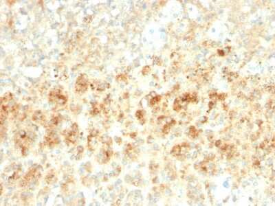 Immunohistochemistry-Paraffin: Perilipin-2/ADFP Antibody (ADFP/2755R) - Azide and BSA Free [NBP3-08454] - Formalin-fixed, paraffin-embedded human Adrenal Gland stained with Perilipin-2/ADFP Recombinant Rabbit Monoclonal Antibody (ADFP/2755R).