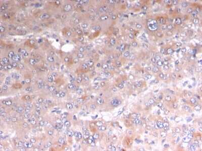 Immunohistochemistry-Paraffin: Perilipin-2/ADFP Antibody (rADFP/1493) - Azide and BSA Free [NBP3-08453] - Formalin-fixed, paraffin-embedded human Adrenal stained with Perilipin-2/ADFP Recombinant Mouse Monoclonal Antibody (rADFP/1493).