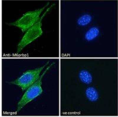 Immunocytochemistry/Immunofluorescence: Perilipin-3/TIP47 Antibody [NBP1-06049] - Immunofluorescence analysis of paraformaldehyde fixed NIH3T3 cells, permeabilized with 0.15% Triton. Primary incubation 1hr (10 ug/mL) followed by Alexa Fluor 488 secondary antibody (2 ug/mL), showing cytoplasmic and lipid droplet staining. The nuclear stain is DAPI (blue). Negative control: Unimmunized goat IgG (10 ug/mL) followed by Alexa Fluor 488 secondary antibody (2 ug/mL).