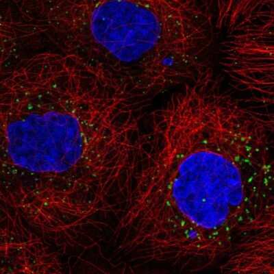 <b>Genetic Strategies Validation. </b>Immunocytochemistry/Immunofluorescence: Perilipin-3/TIP47 Antibody [NBP2-49485] - Analysis of human cell line A-431 shows positivity in vesicles. Antibody staining is shown in green.