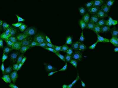 Immunocytochemistry/Immunofluorescence: Perilipin-3/TIP47 Antibody [NBP2-97277] - Immunofluorescence staining of Perilipin-3/TIP47 in A431 cells. Cells were fixed with 4% PFA, permeabilzed with 0.1% Triton X-100 in PBS, blocked with 10% serum, and incubated with rabbit anti-Human Perilipin-3/TIP47 polyclonal antibody (dilution ratio 1:200) at 4C overnight. Then cells were stained with the Alexa Fluor(R)488-conjugated Goat Anti-rabbit IgG Secondary antibody (green) and counterstained with DAPI (blue).Positive staining was localized to Cytoplasm.