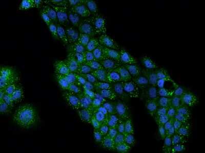 Immunocytochemistry/Immunofluorescence: Perilipin-3/TIP47 Antibody [NBP2-98075] - Immunofluorescence staining of Perilipin-3/TIP47 in A431 cells. Cells were fixed with 4% PFA, permeabilzed with 0.1% Triton X-100 in PBS, blocked with 10% serum, and incubated with rabbit anti-Human Perilipin-3/TIP47 polyclonal antibody (dilution ratio 1:200) at 4C overnight. Then cells were stained with the Alexa Fluor(R)488-conjugated Goat Anti-rabbit IgG Secondary antibody (green) and counterstained with DAPI (blue).Positive staining was localized to Cytoplasm.