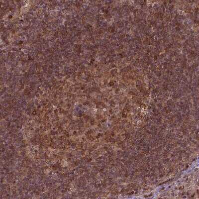 Immunohistochemistry-Paraffin: Perilipin-3/TIP47 Antibody [NBP2-49485] - Staining of human lymph node shows moderate cytoplasmic positivity in germinal center cells.