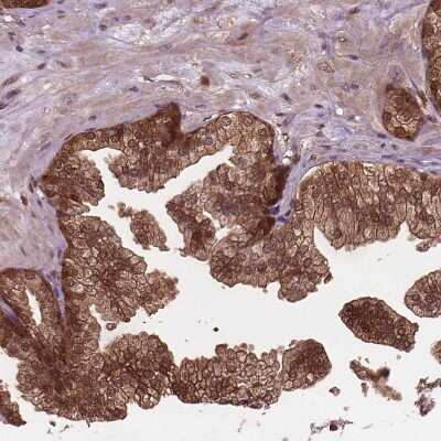 Immunohistochemistry-Paraffin: Perilipin-3/TIP47 Antibody [NBP2-49485] - Staining of human prostate shows moderate cytoplasmic positivity in glandular cells.