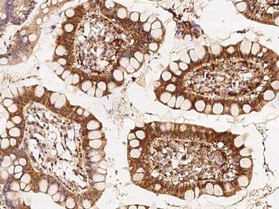 Immunohistochemistry-Paraffin: Perilipin-3/TIP47 Antibody [NBP2-97277] - Immunochemical staining of human PLIN3 in human small intestine with rabbit polyclonal antibody at 1:500 dilution, formalin-fixed paraffin embedded sections.