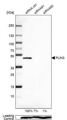 Western Blot: Perilipin-3/TIP47 Antibody [NBP2-49485] - Analysis in U-87MG ATCC cells transfected with control siRNA, target specific siRNA probe #1 and #2,. Remaining relative intensity is presented. Loading control: Anti-PPIB.