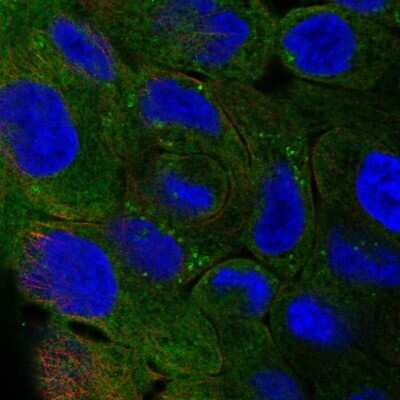 Immunocytochemistry/Immunofluorescence: Perilipin-4 Antibody [NBP2-13776] - Staining of human cell line RT4 shows localization to plasma membrane, cytosol & lipid droplets. Antibody staining is shown in green.