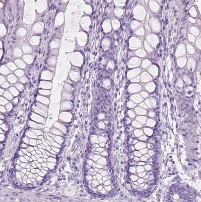 Immunohistochemistry-Paraffin: Perilipin-4 Antibody [NBP2-13776] - Staining of human colon shows no positivity in glandular cells as expected.