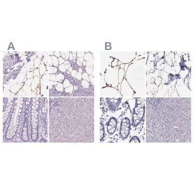 Immunohistochemistry-Paraffin: Perilipin-4 Antibody [NBP2-13776] - Staining of human adipose tissue, breast, colon and liver using Anti-Perilipin-4 antibody NBP2-13776 (A) shows similar protein distribution across tissues to independent antibody NBP2-38731 (B).