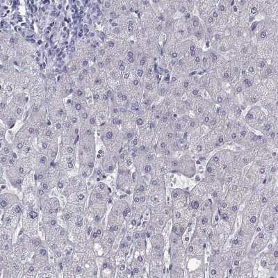 Immunohistochemistry-Paraffin: Perilipin-4 Antibody [NBP2-38731] - Staining of human liver shows low expression as expected.