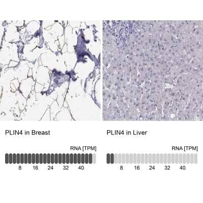 <b>Orthogonal Strategies Validation. </b>Immunohistochemistry-Paraffin: Perilipin-4 Antibody [NBP2-38731] - Staining in human breast and liver tissues using anti-PLIN4 antibody. Corresponding PLIN4 RNA-seq data are presented for the same tissues.