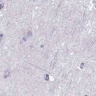 Immunohistochemistry-Paraffin: Perilipin-4 Antibody [NBP2-38731] - Staining of human cerebral cortex.