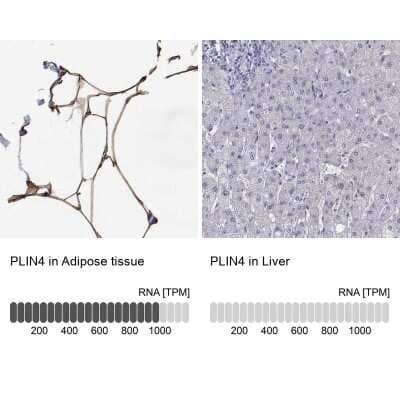 <b>Orthogonal Strategies Validation. </b>Immunohistochemistry-Paraffin: Perilipin-4 Antibody [NBP2-38731] - Analysis in human adipose tissue and liver tissues. Corresponding Perilipin-4 RNA-seq data are presented for the same tissues.