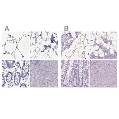 <b>Independent Antibodies Validation. </b>Immunohistochemistry-Paraffin: Perilipin-4 Antibody [NBP2-38731] - Staining of human adipose tissue, breast, colon and liver using Anti-Perilipin-4 antibody NBP2-38731 (A) shows similar protein distribution across tissues to independent antibody NBP2-13776 (B).