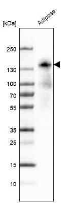 Western Blot: Perilipin-4 Antibody [NBP2-13776] - Analysis in human adipose tissue .