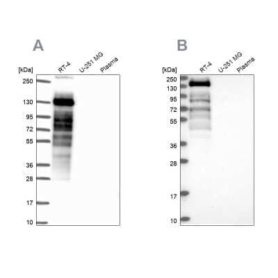 <b>Independent Antibodies Validation. </b>Western Blot: Perilipin-4 Antibody [NBP2-38731] - Analysis using Anti-PLIN4 antibody NBP2-38731 (A) shows similar pattern to independent antibody NBP2-13776 (B).