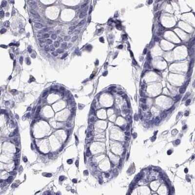 Western Blot: Perilipin-4 Antibody [NBP2-38731] - Staining of human colon.