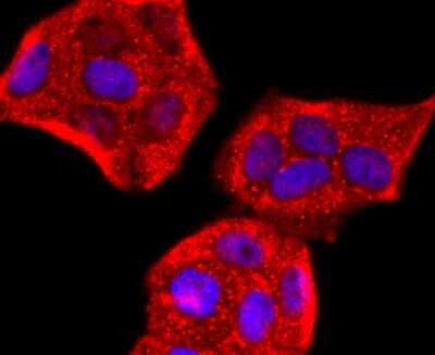 Immunocytochemistry/Immunofluorescence: Perilipin Antibody (JM10-96) [NBP2-67037] - Staining Perilipin A in Hela cells (red). The nuclear counter stain is DAPI (blue). Cells were fixed in paraformaldehyde, permeabilised with 0.25% Triton X100/PBS.