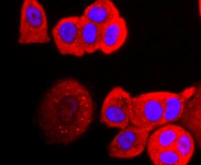 Immunocytochemistry/Immunofluorescence: Perilipin Antibody (JM10-96) [NBP2-67037] - Staining Perilipin A in MCF-7 cells (red). The nuclear counter stain is DAPI (blue). Cells were fixed in paraformaldehyde, permeabilised with 0.25% Triton X100/PBS.